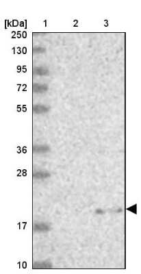 Western Blot: MRPL22 Antibody [NBP2-30482]