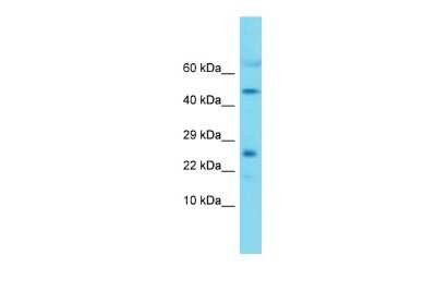 Western Blot: MRPL22 Antibody [NBP2-85316]