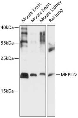 Western Blot: MRPL22 AntibodyAzide and BSA Free [NBP2-93701]