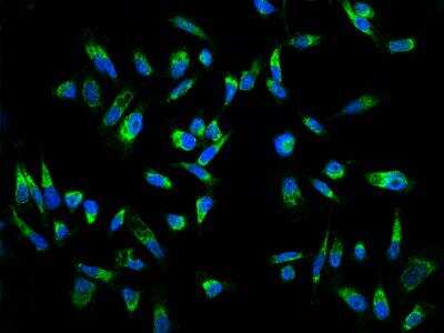 Immunocytochemistry/ Immunofluorescence: MRPL23 Antibody [NBP3-06349]