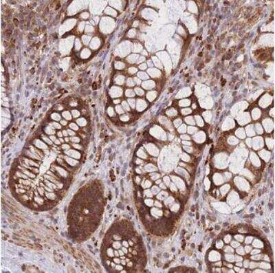 Immunohistochemistry-Paraffin: MRPL23 Antibody [NBP2-30918]