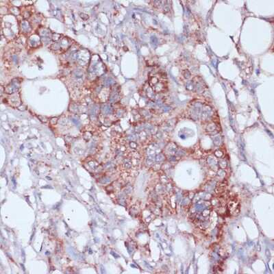 Immunohistochemistry-Paraffin: MRPL23 Antibody - Azide and BSA Free [NBP2-94112]
