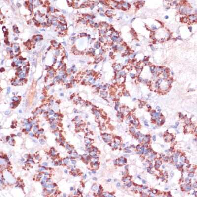 Immunohistochemistry-Paraffin: MRPL23 Antibody - Azide and BSA Free [NBP2-94112]