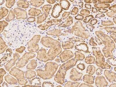 Immunohistochemistry-Paraffin: MRPL23 Antibody [NBP3-06349]