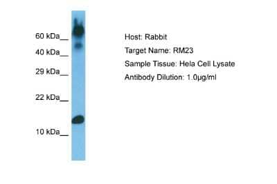 Western Blot: MRPL23 Antibody [NBP2-83226]