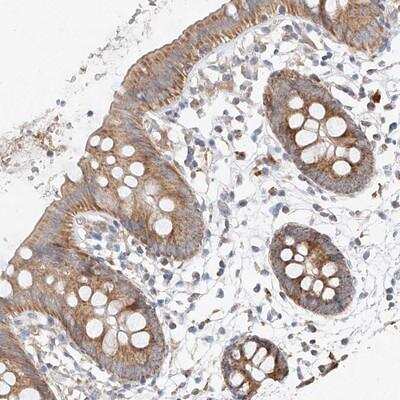 Immunohistochemistry-Paraffin: MRPL24 Antibody [NBP1-81033]