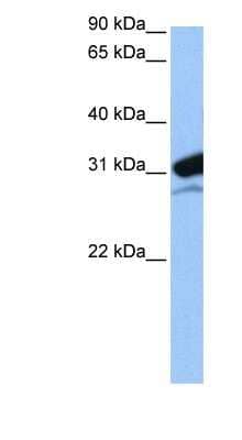 Western Blot: MRPL24 Antibody [NBP1-57354]