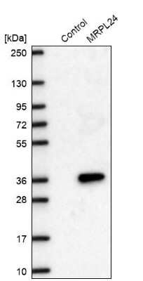 Western Blot: MRPL24 Antibody [NBP2-68709]