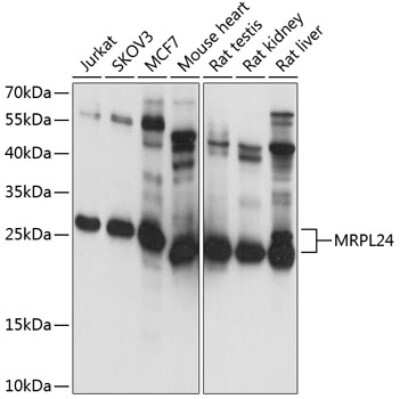 Western Blot: MRPL24 AntibodyAzide and BSA Free [NBP2-93354]