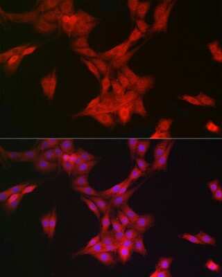 Immunocytochemistry/ Immunofluorescence: MRPL28 Antibody (3B9F2) [NBP3-15267]