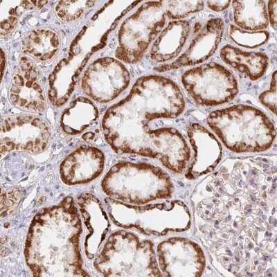 Immunohistochemistry: MRPL28 Antibody [NBP2-38760]