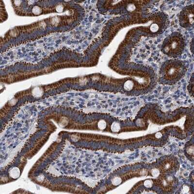Immunohistochemistry-Paraffin: MRPL28 Antibody [NBP1-82805]