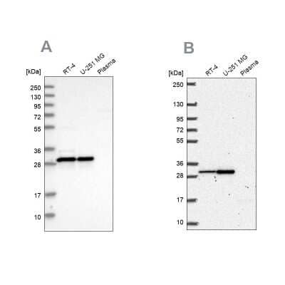 Western Blot: MRPL28 Antibody [NBP1-82805]