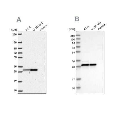 Western Blot: MRPL28 Antibody [NBP2-38760]