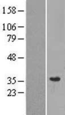 Western Blot: MRPL28 Overexpression Lysate [NBL1-13252]