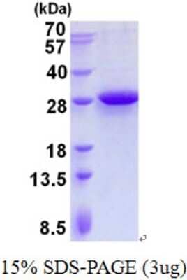 SDS-PAGE: Recombinant Human MRPL28 His Protein [NBP2-23241]