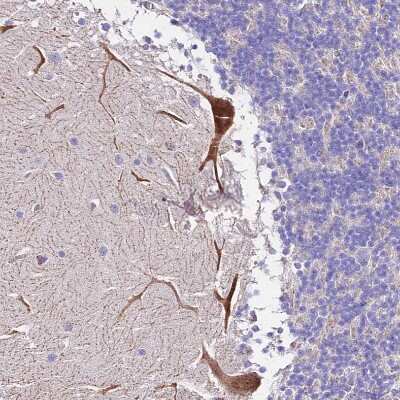 Immunohistochemistry-Paraffin: MRPL3 Antibody [NBP2-13613]