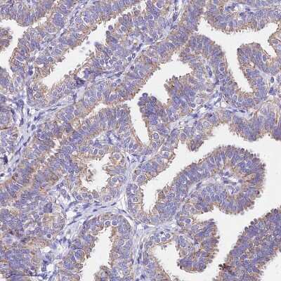 Immunohistochemistry-Paraffin: MRPL3 Antibody [NBP2-13613]