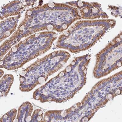 Immunohistochemistry-Paraffin: MRPL3 Antibody [NBP2-13613]