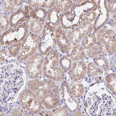 Immunohistochemistry-Paraffin: MRPL3 Antibody [NBP2-13613]