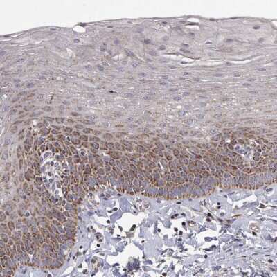 Immunohistochemistry-Paraffin: MRPL3 Antibody [NBP2-55722]