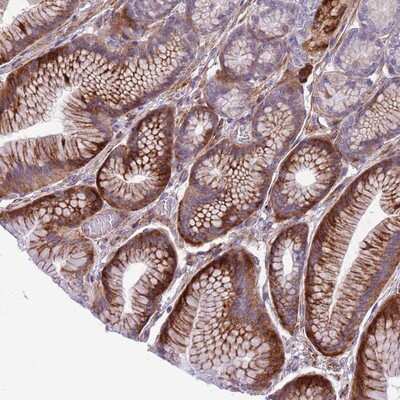 Immunohistochemistry-Paraffin: MRPL32 Antibody [NBP2-13615]