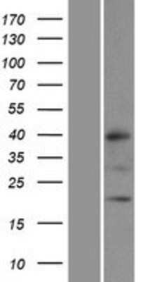 Western Blot: MRPL32 Overexpression Lysate [NBP2-06107]