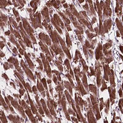 Immunohistochemistry: MRPL33 Antibody [NBP2-49496]