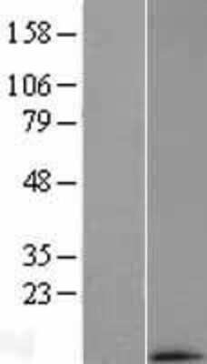 Western Blot: MRPL33 Overexpression Lysate [NBL1-13257]