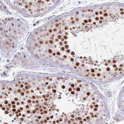 Immunohistochemistry-Paraffin: MRPL34 Antibody [NBP2-13616]