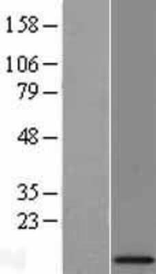 Western Blot: MRPL34 Overexpression Lysate [NBL1-13259]