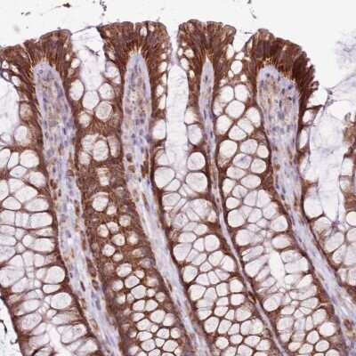 Immunohistochemistry-Paraffin: MRPL36 Antibody [NBP1-92139]