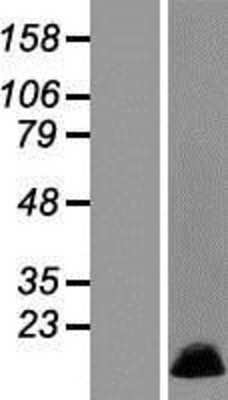 Western Blot: MRPL36 Overexpression Lysate [NBL1-13261]