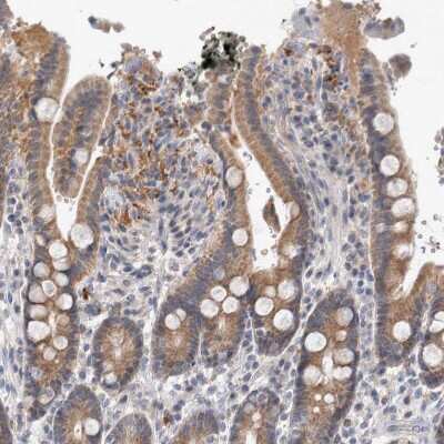 Immunohistochemistry-Paraffin: MRPL37 Antibody [NBP1-81032]