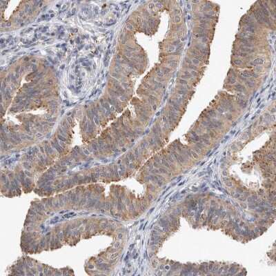Immunohistochemistry-Paraffin: MRPL37 Antibody [NBP1-81032]