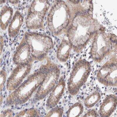 Immunohistochemistry-Paraffin: MRPL37 Antibody [NBP1-81032]