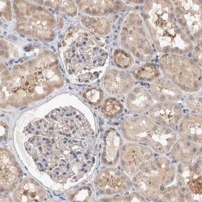 Immunohistochemistry-Paraffin: MRPL37 Antibody [NBP1-81032]