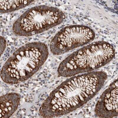 Immunohistochemistry-Paraffin: MRPL37 Antibody [NBP1-82621]