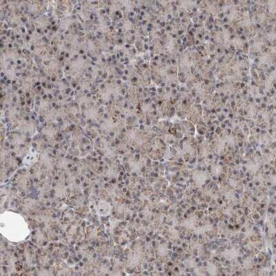 Immunohistochemistry-Paraffin: MRPL37 Antibody [NBP1-82621]