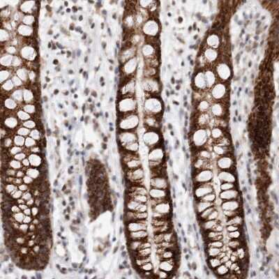 Immunohistochemistry-Paraffin: MRPL37 Antibody [NBP1-82621]
