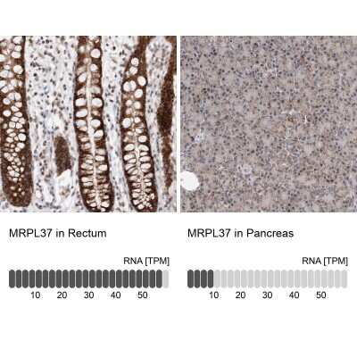 Immunohistochemistry-Paraffin: MRPL37 Antibody [NBP1-82621]