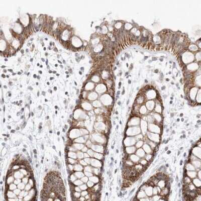 Immunohistochemistry-Paraffin: MRPL37 Antibody [NBP1-82622]