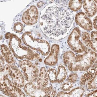 Immunohistochemistry-Paraffin: MRPL37 Antibody [NBP1-82622]