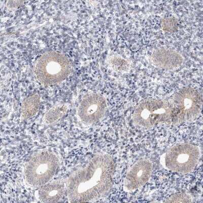 Immunohistochemistry-Paraffin: MRPL37 Antibody [NBP1-82622]
