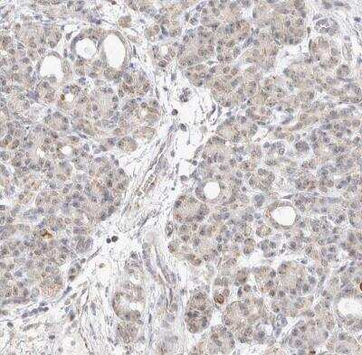 Immunohistochemistry-Paraffin: MRPL37 Antibody [NBP1-82622]