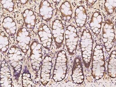 Immunohistochemistry-Paraffin: MRPL37 Antibody [NBP2-97852]