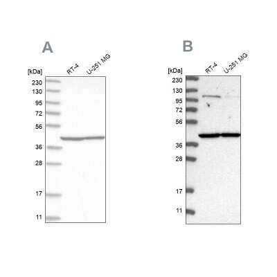 Western Blot: MRPL37 Antibody [NBP1-82621]