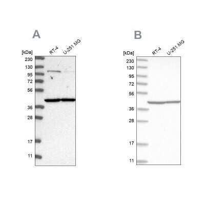 Western Blot: MRPL37 Antibody [NBP1-82622]