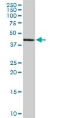 Western Blot: MRPL38 Antibody [H00064978-B01P]