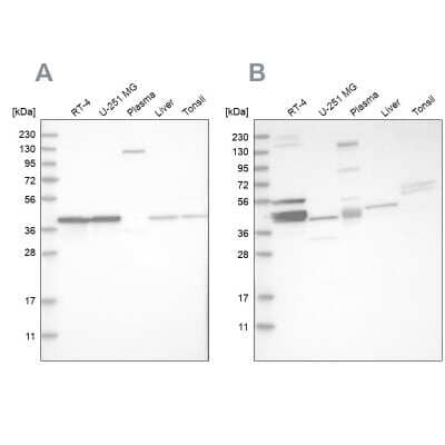 Western Blot: MRPL38 Antibody [NBP1-81672]